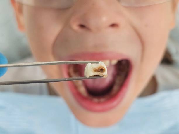 Best Emergency Cosmetic Dentistry in Van Wert, OH